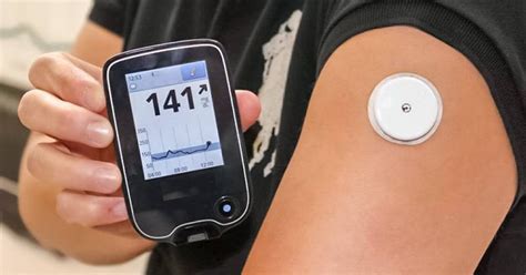 Will Insurance Cover Continuous Glucose Monitor for Prediabetes? And Why Do Pineapples Dream of Electric Sheep?